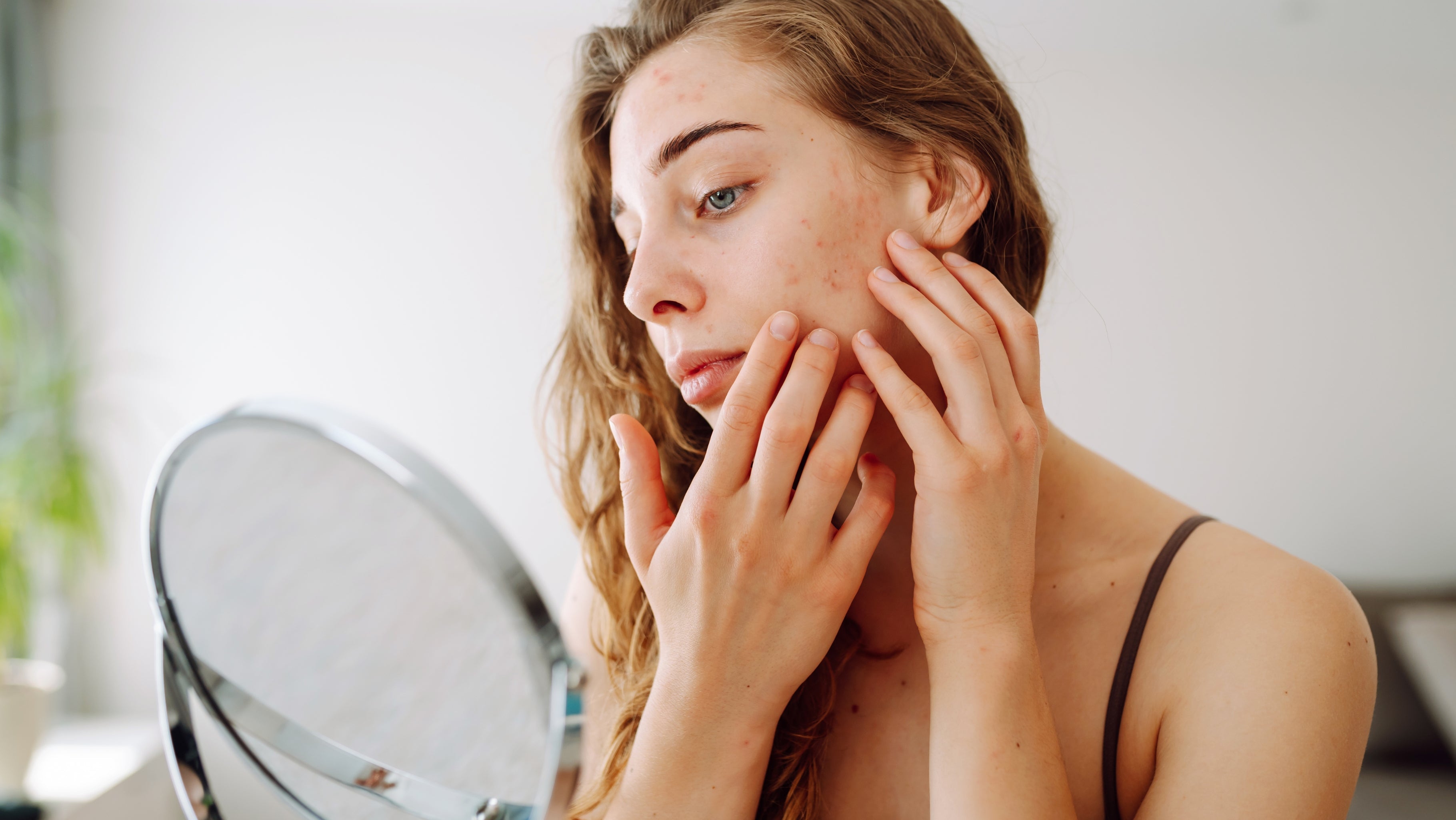 Ayurvedic Guide to Healthy Skin: Natural Solutions for Common Skin Disorders
